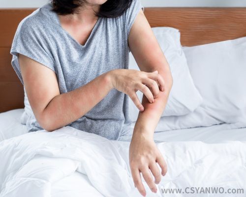 阿司匹林过敏